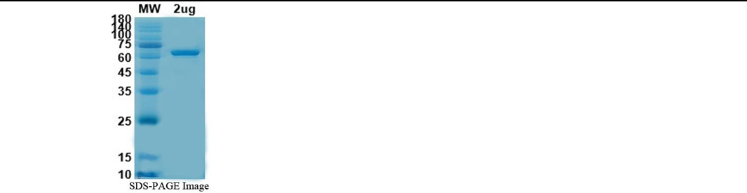 SDS-PAGE for Human AXL protein