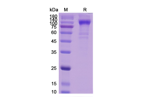 SDS-PAGE for Human ErbB2 Recombinant Protein