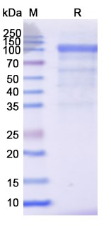 SDS-PAGE for Human LGR4 recombinant protein