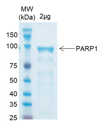 SDS-PAGE for Human PARP1 Recombinant Protein