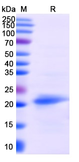 SDS-PAGE for IFNB1 / IFN-beta, N-His, recombinant protein