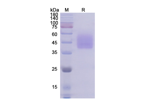 SDS-PAGE for ICOSL Protein- Human ICOS ligand recombinant protein- CD278 Protein