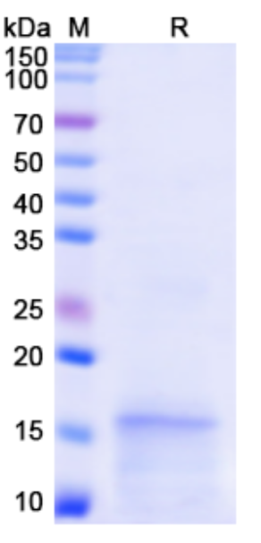 SDS-PAGE For Monkeypox virus/MPXV D6L Recombinant Protein, N-His