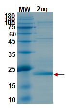 SDS-PAGE for NSP1 Recombinant proteins
