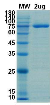 SDS-PAGE for NSP2 Recombinant proteins