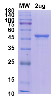 SDS-PAGE for Nucleoprotein Recombinant proteins