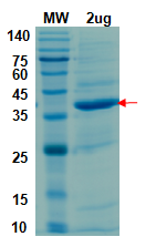SDS-PAGE for Peptidase C16 domain of PL-Pro (746-1064), nsp3
