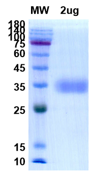 SDS-PAGE for RBD Domain Recombinant proteins