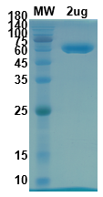 SDS-PAGE for RBD-Fc Recombinant proteins