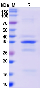 SDS-PAGE For Recombinant Monkeypox virus/MPXV A26L Protein, N-GST &amp C-His