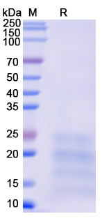 SDS-PAGE For Recombinant Monkeypox virus/MPXV A29L Protein