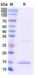 SDS-PAGE For Recombinant Monkeypox virus/MPXV A33R Protein, N-His
