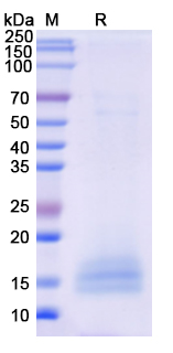 SDS-PAGE For Recombinant Monkeypox virus/MPXV A35R Protein