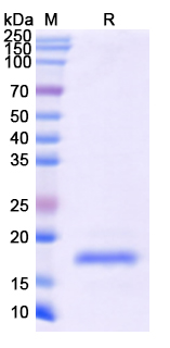 SDS-PAGE For Recombinant Monkeypox virus/MPXV A36R Protein, N-His