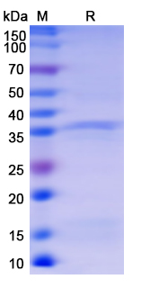 SDS-PAGE For Recombinant Monkeypox virus/MPXV B5R Protein, N-His