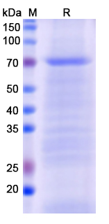 SDS-PAGE For Recombinant Monkeypox virus/MPXV C18L Protein, N-His
