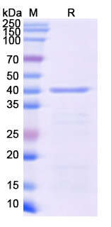 SDS-PAGE For Recombinant Monkeypox virus/MPXV C19L Protein, N-His