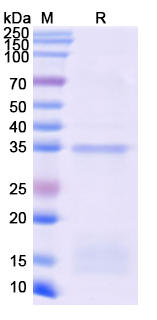 SDS-PAGE For Recombinant Monkeypox virus/MPXV D13L Protein, N-His