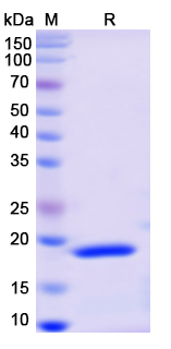 SDS-PAGE for Recombinant Monkeypox virus/MPXV F3L Protein