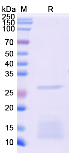 SDS-PAGE for Recombinant Monkeypox virus/MPXV H3L Protein, N-His