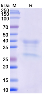SDS-PAGE For Recombinant Monkeypox virus/MPXV H3L Protein