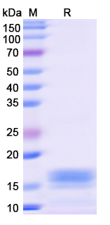SDS-PAGE For Recombinant Monkeypox virus/MPXV L1R Protein