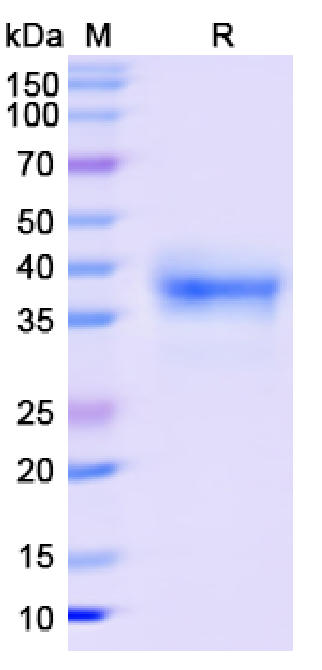 SDS-PAGE for SARS-CoV-2 RBD of Spike proteinâ€“BA.4 lineage B.1.1.529.4 â€“ Omicron Variant