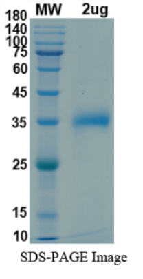 SDS-PAGE for SARS-CoV-2 RBD of Spike protein, K417N, T478K, L452Râ€“ lineage B.1.617.2.1 â€“ Indian Delta Plus Variant