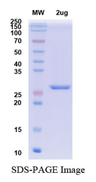 SDS-PAGE for SARS-CoV-2 RBD of Spike proteinâ€“ lineage B.1.1.529 â€“ Omicron Variant