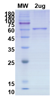 SDS-PAGE for Spike protein S2 Recombinant proteins