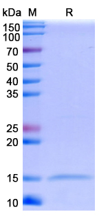 SDS-PAGE for T cell receptor delta variable 1(TRDV1)