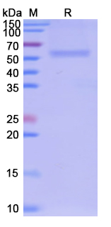 SDS-PAGE for TNFSF4 recombinant protein