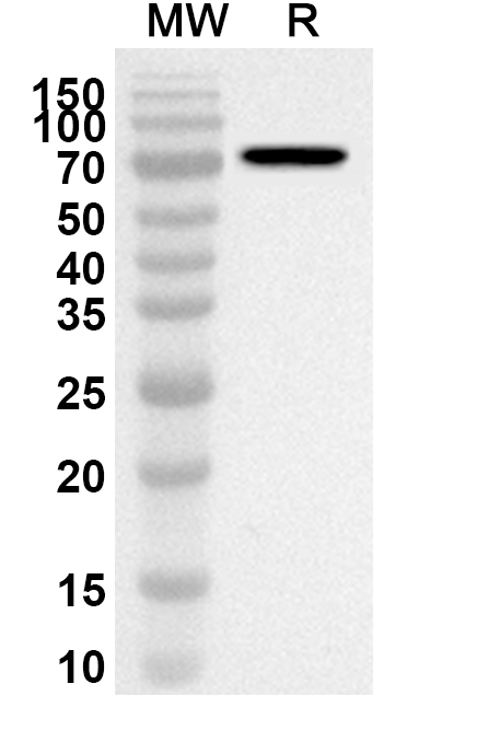 AGT Polyclonal Antibody binds to AGT, N-GST, recombinant protein in WB Assay