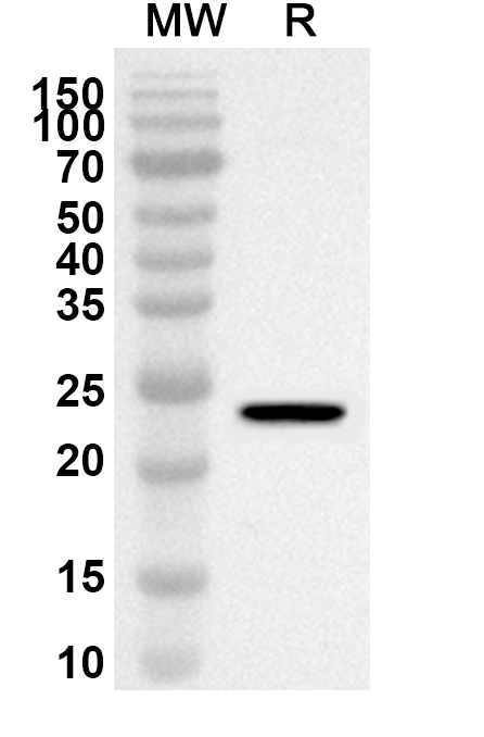 Anti-A1CF Polyclonal antibody binds to Recombinant Human A1CF, N-His in WB Assay