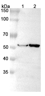 Anti-ABAT Polyclonal Antibody binds to Recombinant Human ABAT, N-His in WB Assay