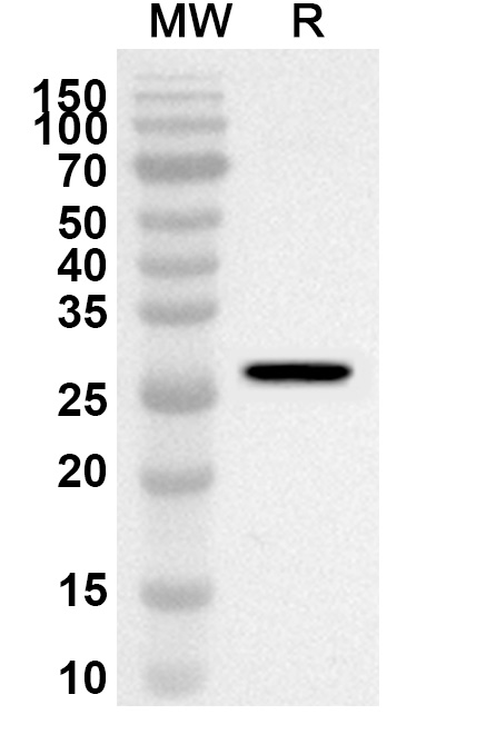 Anti-ABCA1 Polyclonal Antibody binds to Mouse ABCA1 Recombinant Protein, N-His in WB Assay