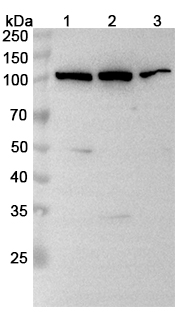 Anti-ABCB6 Polyclonal Antibody binds to Recombinant Human ABCB6, N-His in WB Assay