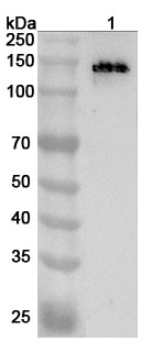 Anti-ABCC8 Polyclonal Antibody binds to Recombinant Human ABCC8, N-His in WB Assay