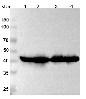 Anti-ACAA2 Polyclonal antibody binds to Recombinant Human ACAA2, N-His in WB Assay