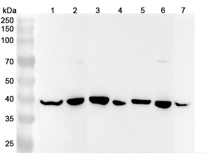 Anti-ACAT2 Polyclonal Antibody binds to Recombinant Human ACAT2, N-His in WB Assay