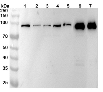 Anti-ACO1 Polyclonal Antibody binds to Recombinant Human ACO1 Protein, N-His in WB Assay