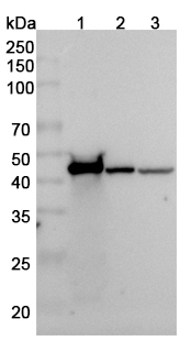Anti-ACTG1 Polyclonal antibody binds to Recombinant Human ACTG1, N-His in WB Assay