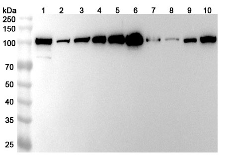 Anti-ACTN4 Polyclonal antibody binds to Recombinant Human ACTN4, N-His in WB Assay