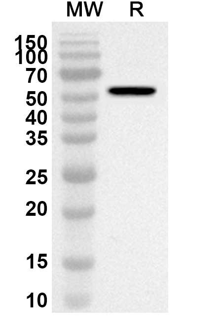 Anti-Adalimumab Polyclonal Antibody in WB Assay