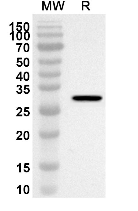 Anti-ADAM20 Polyclonal Antibody binds to Recombinant Human ADAM20, N-His in WB Assay