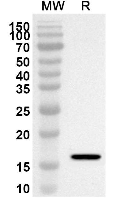 Anti-ADRA1A Polyclonal Antibody binds to Recombinant Human ADRA1A, N-His in WB Assay