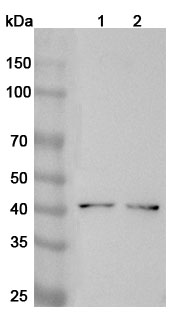 Anti-AIM2 Polyclonal Antibody binds to Recombinant Human AIM2, N-His in WB Assay