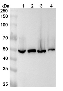 Anti-ALDH9A1 Polyclonal Antibody binds to Recombinant Human ALDH9A1 Protein, N-His in WB Assay