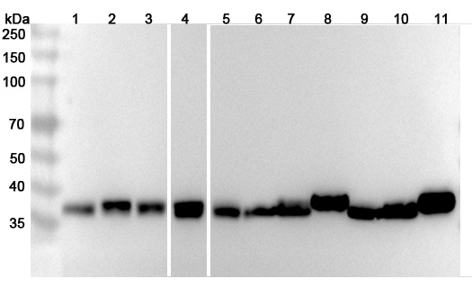 Anti-ALDOA Polyclonal antibody binds to Recombinant Human ALDOA, N-His in WB Assay