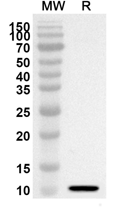 Anti-ANO6 Polyclonal antibody binds to Recombinant Human ANO6, N-His in WB Assay